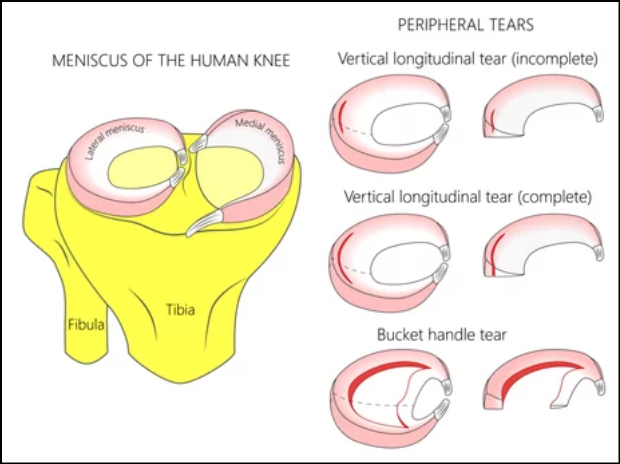 Meniscus of the human knee