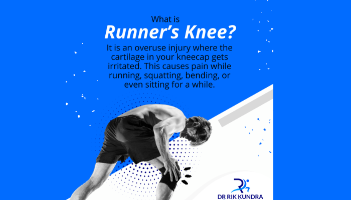 What is Runners knee
