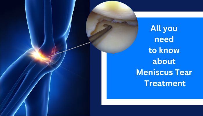 meniscus tear treatment