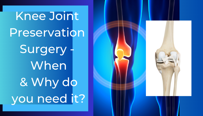 knee joint preservation surgery
