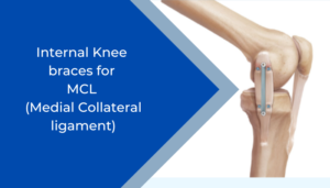 internal knee braces