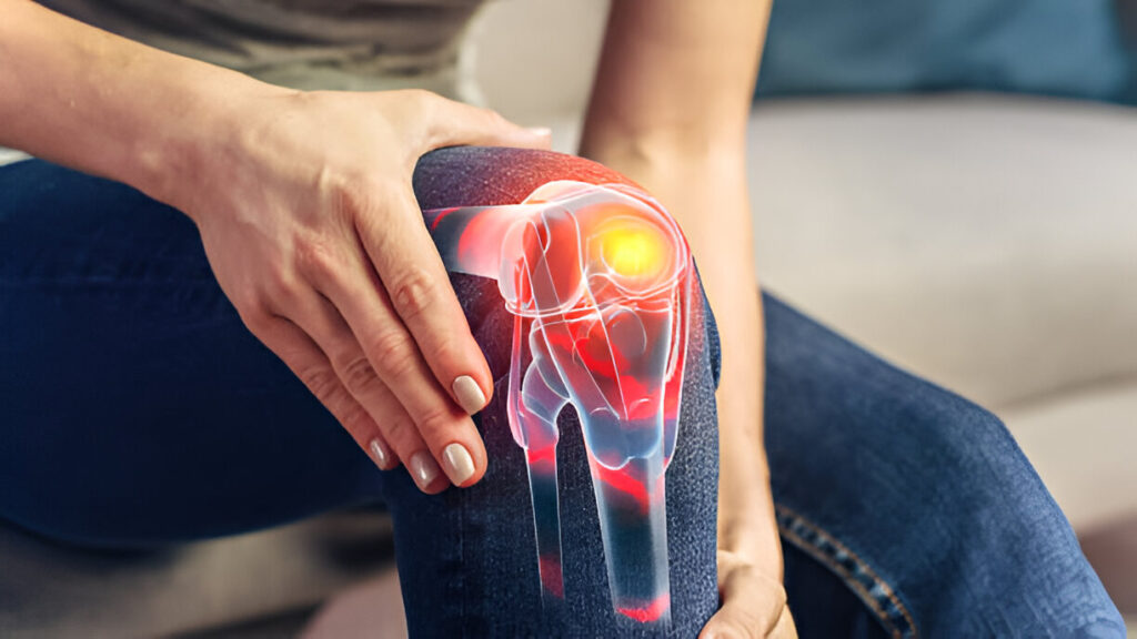 Symptoms Of Arthritis In Knee