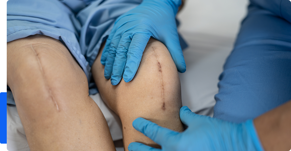 Knee Osteotomy Surgery In Dubai