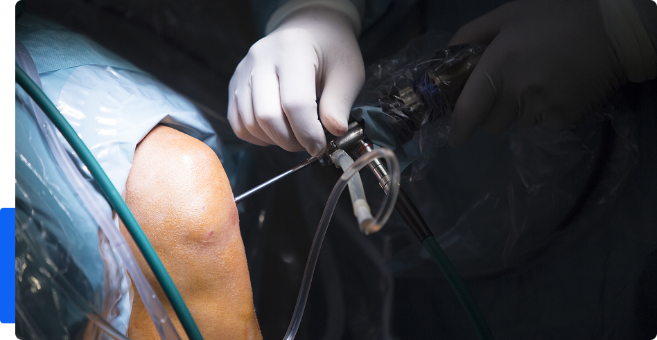 Meniscal Surgery In Dubai