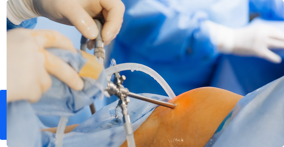 ACL Surgery Dubai - Dr Rik Kundra
